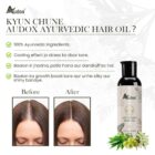 Ayurvedic Hair Oil Audox–120 ml - Image 4
